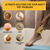 Maryton Glass Pumice Stone for Feet Hard Skin Callus Remover and Scrubber,Bulk Pack of 4(Assorted Colors)